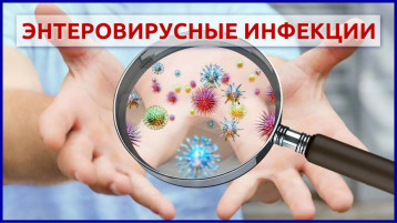 Меры профилактики кишечных инфекции. Энтеровирусные инфекции Меры профилактики кишечных инфекции. Энтеровирусные инфекции.